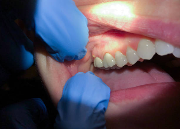 Best Emergency Denture Repair in Camden, SC